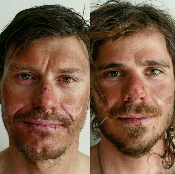 Portreta, ki sta v začetku marca pretresla javnost. | Foto: Instagram/Getty Images