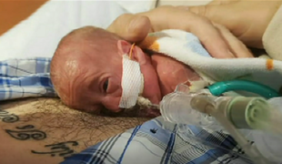 Dojenček, ki velja za medicinski čudež #video