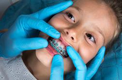 Tako bi uredili ortodontsko zdravljenje otrok