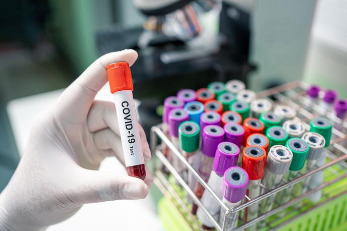 Covid. Koronavirus. Testiranje. Korona. Covid-19 | V Sloveniji so v četrtek spet potrdili več kot dva tisoč novih okužb.  | Foto Shutterstock