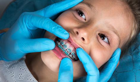 Tako bi uredili ortodontsko zdravljenje otrok