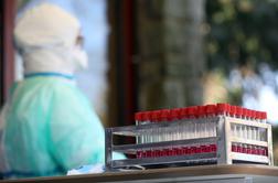 V Hrastniku že 35 okuženih z novim koronavirusom 