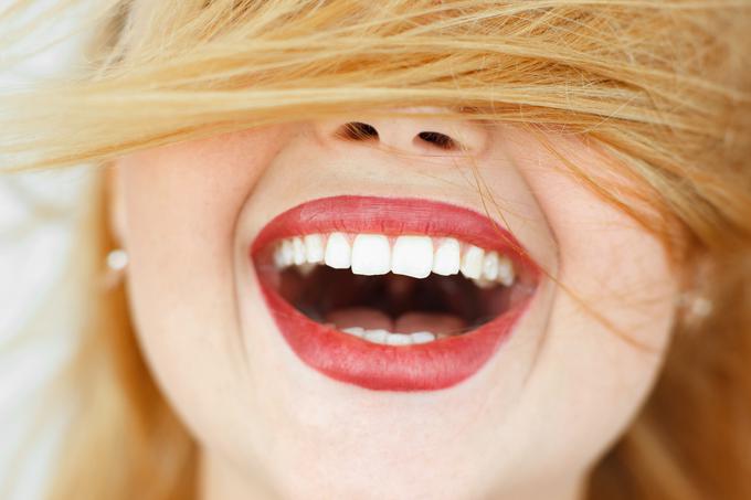 beli zobje nasmeh ženska | Foto: Thinkstock