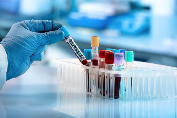 izvid krvi krvni test kri | Foto Shutterstock